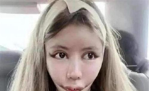 之前很红的整容网红,揭秘网红变脸背后的秘密